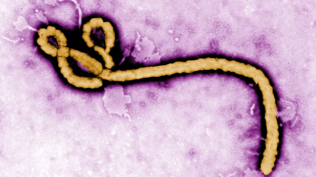10 Things To Know About Ebola Virus In Nigeria