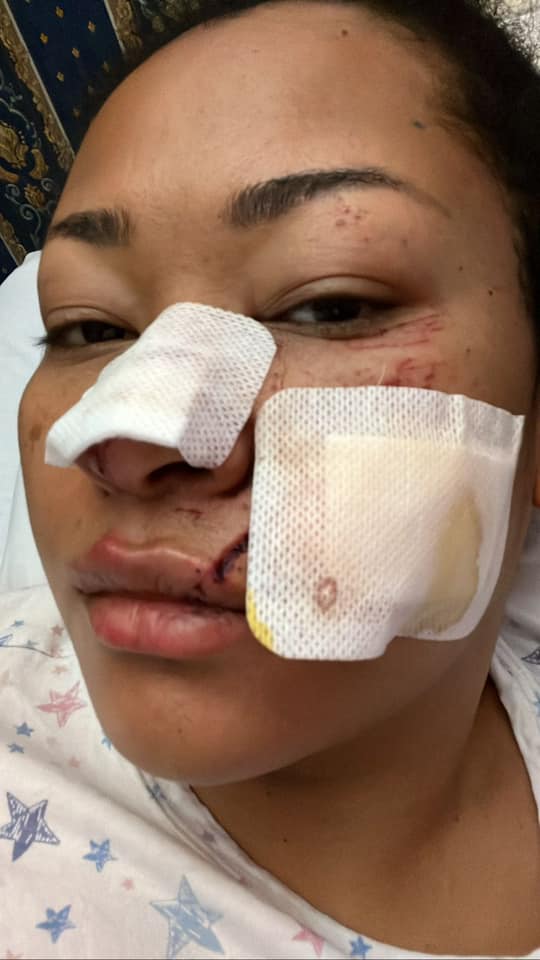 Spirit Unbroken - Natasha Akpoti-Uduaghan Says As She Survives Accident
