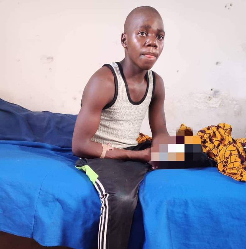 Bandits Cut Off My Arm Despite N1m Ransom - 19-Year Old Kaduna Boy