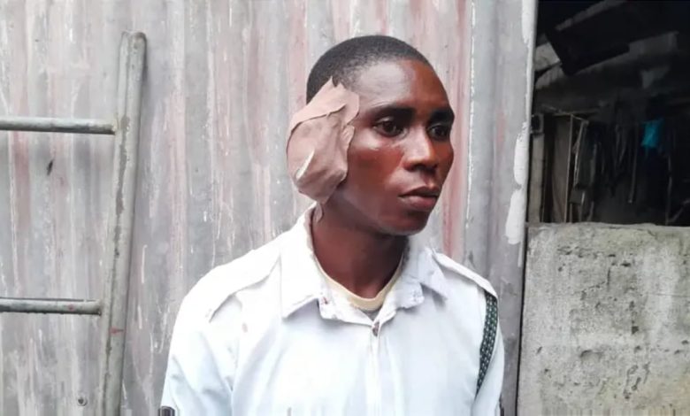 Angry Driver Bites Off VIO Officer’s Ear in Warri