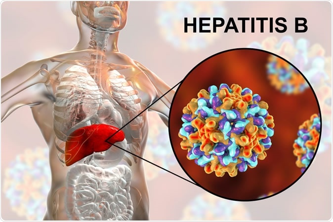 19m Nigerians Living With Hepatitis – FG