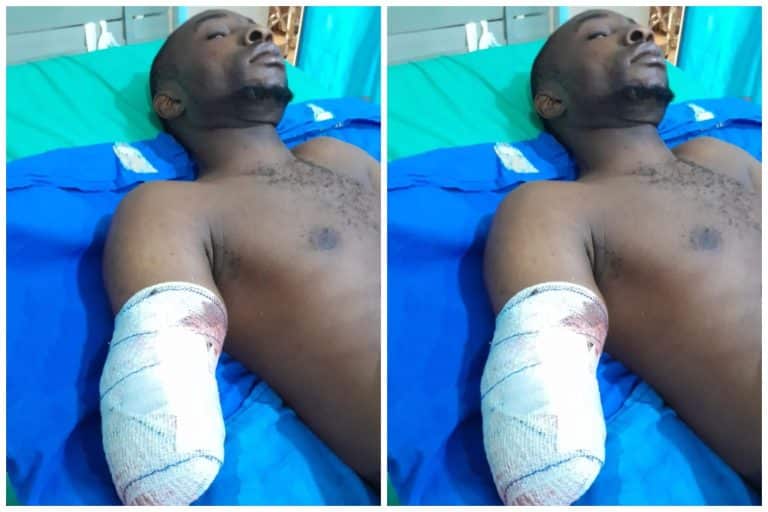 Ogun Police Launches Investigation As Industrial Machine Cuts Off Worker’s Hand 