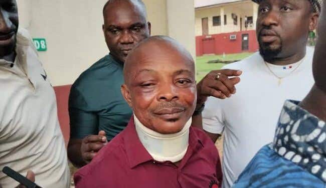 My Brother, They Beat Me O” – NLC President, Joe Ajaero, Narrates His Ordeal [VIDEO]