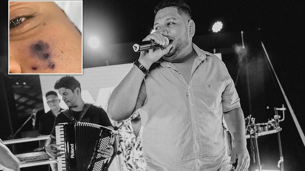 Brazilian Singer, Darlyn Morais Dies After Being Bitten By A Spider