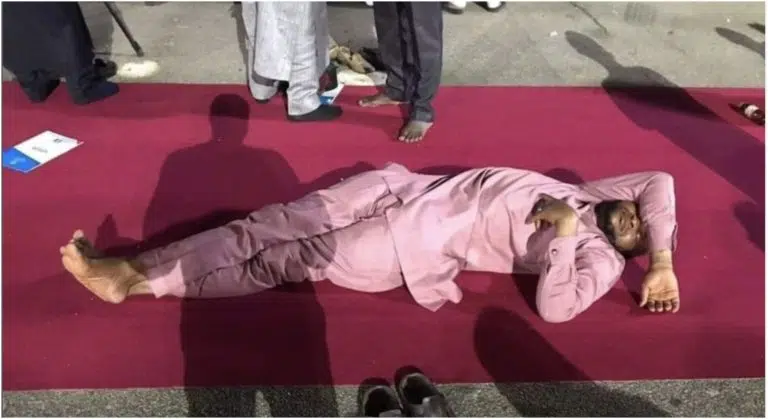 Man Dies After Wife Forced Him To Get Surgery For Snoring