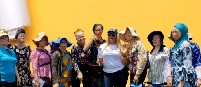 Implement National Policy To Protect Our Members - Albinism Association Tells FG