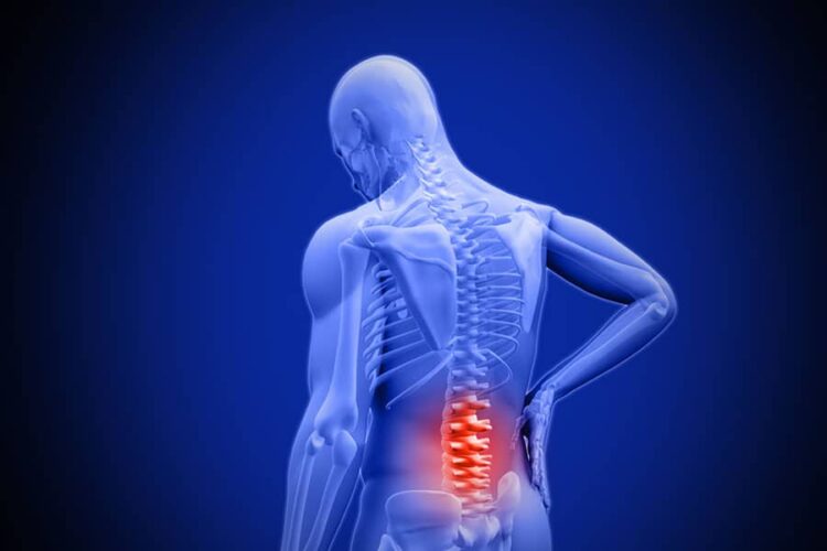 See What To Do To Reduce Back Pain