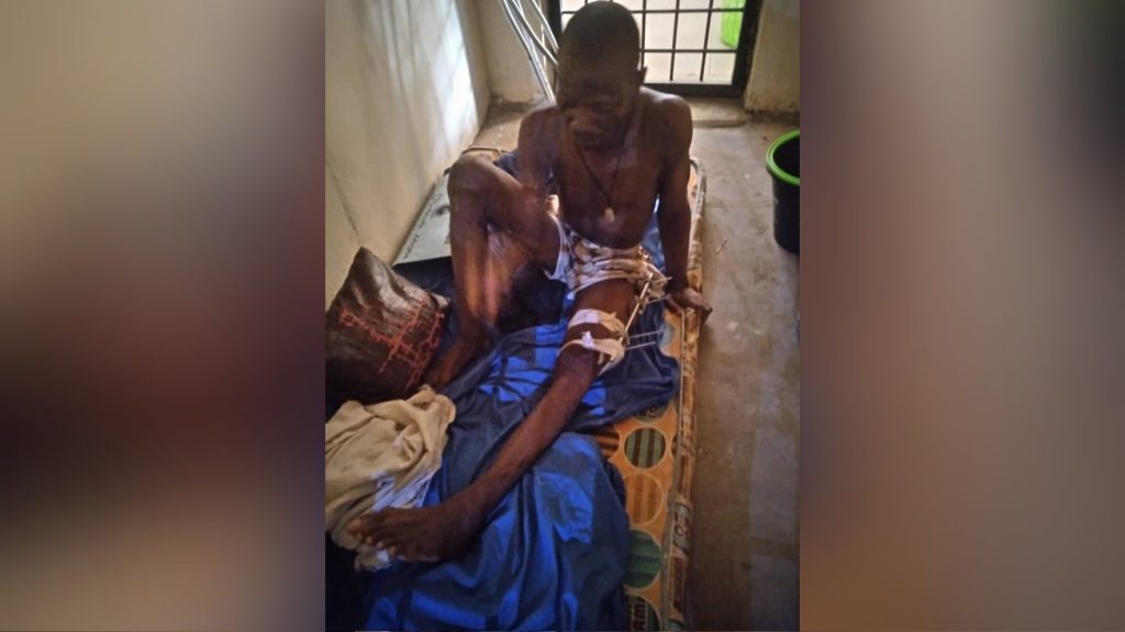 Nigerian Soldier Shot In Sokoto Barracks Protest Against Poor Feeding, Overcrowded Cells, Returns To Cell On Crutches