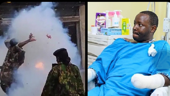 Kenyan Police Officer Loses Both Forearms After Trying To Throw  Teargas Canister At Peaceful Protesters In Nairobi [Video]