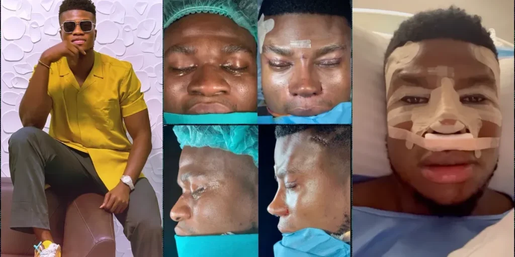 'Hope He Disabled His Face ID Before The Surgery' -Reactions As Skit Maker, Zics Aloma Gets Nose, Eyelid And Facelift Surgery In Turkey