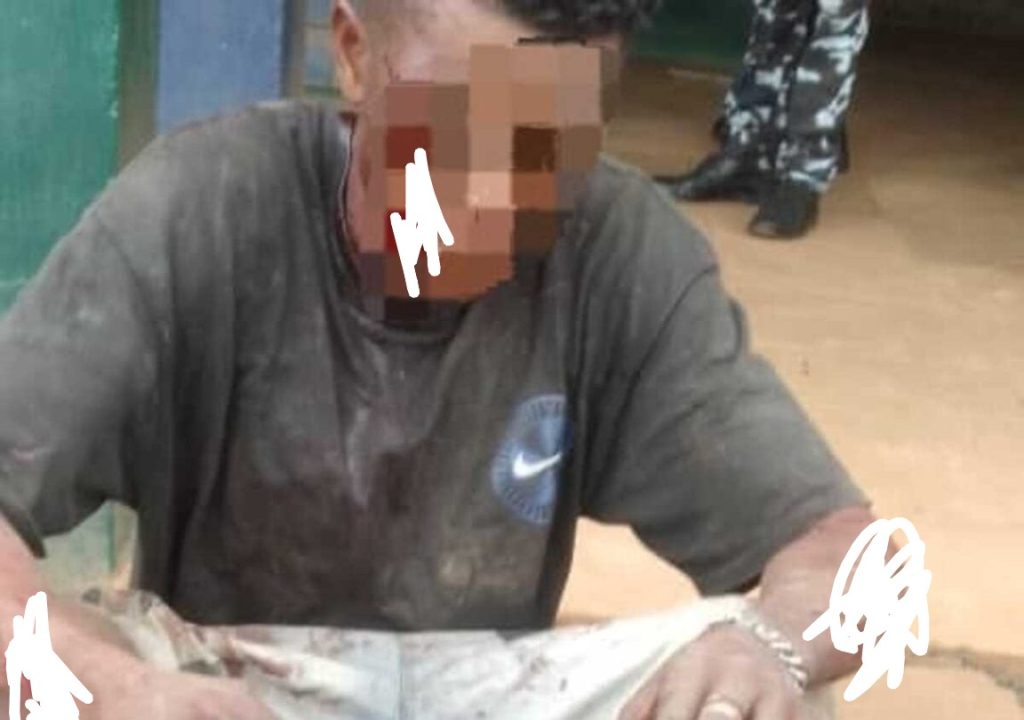 Man Found With Human Leg Escapes Jungle Justice In Oyo