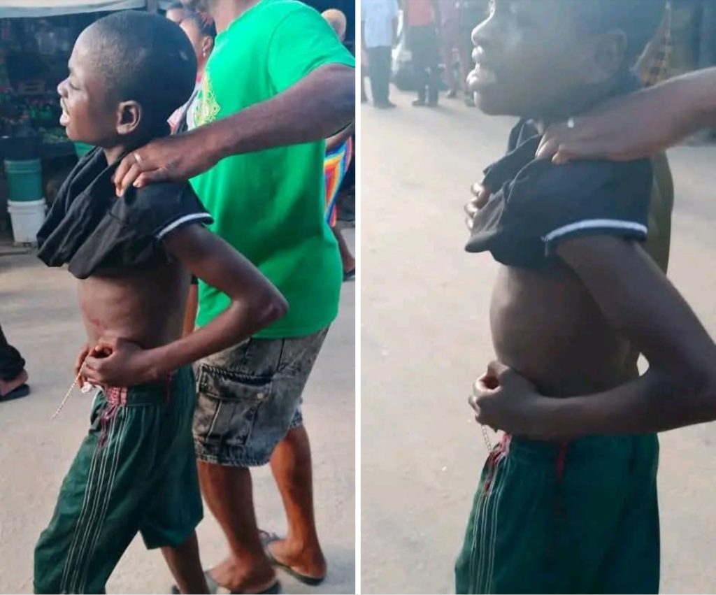 Stray Bullet Hits Boy During NDLEA Operations In Bakassi