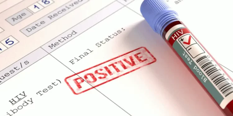 REPORT: More Than Half Of New HIV Patients Are Among Young People Aged 15 To 24