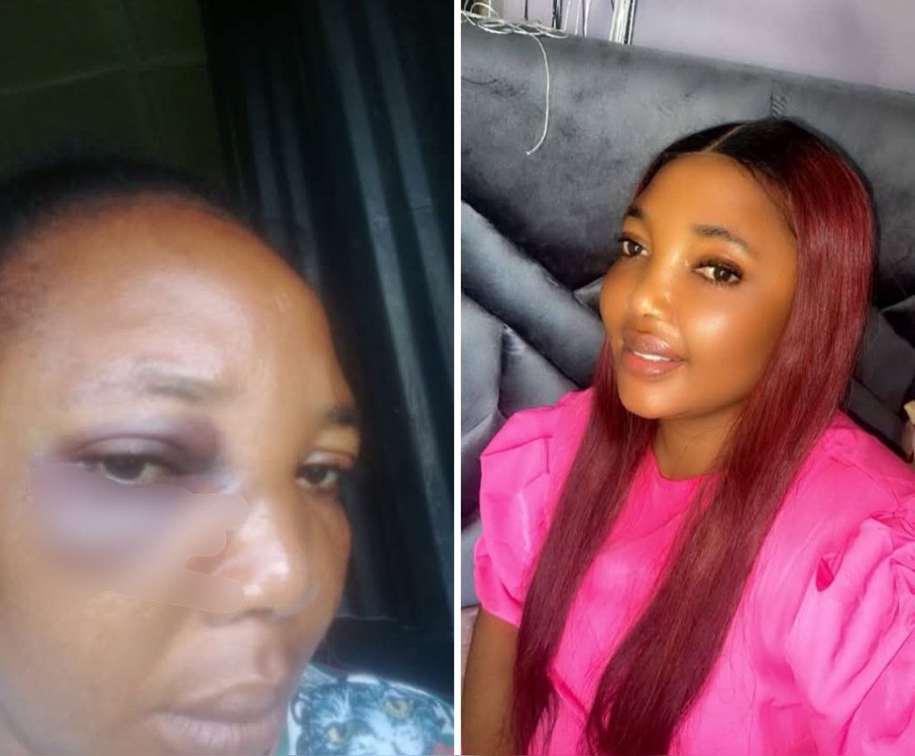 "I Leave To Live For My Child" - Woman Writes As She Shares What She Allegedly Went Through In Marriage
