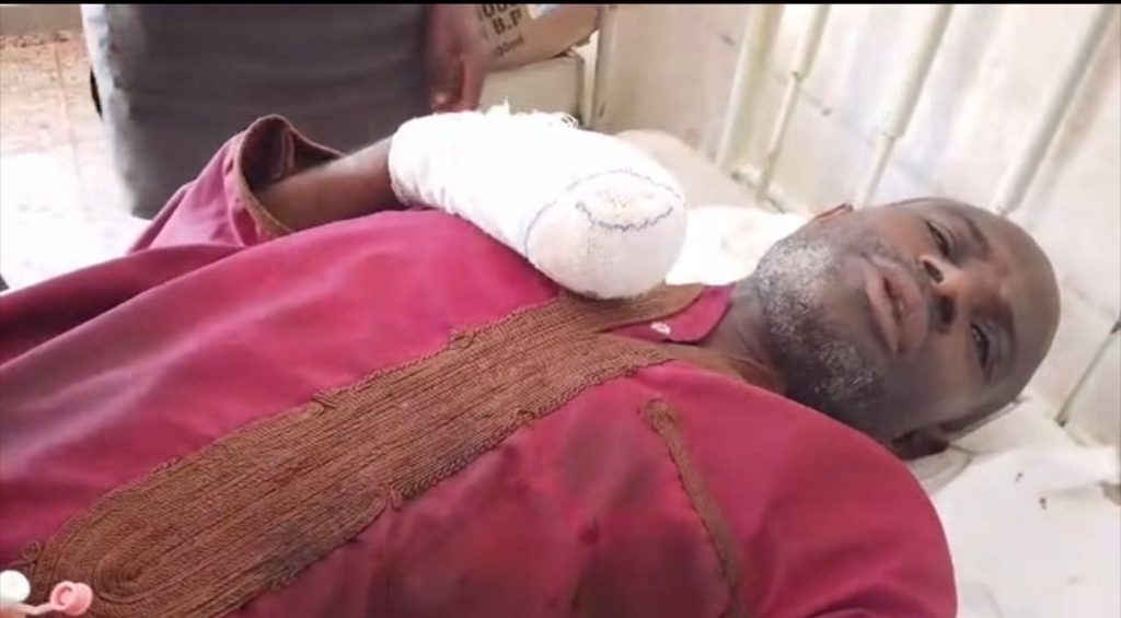 Fulani Man Dies After Shooting in Plateau 