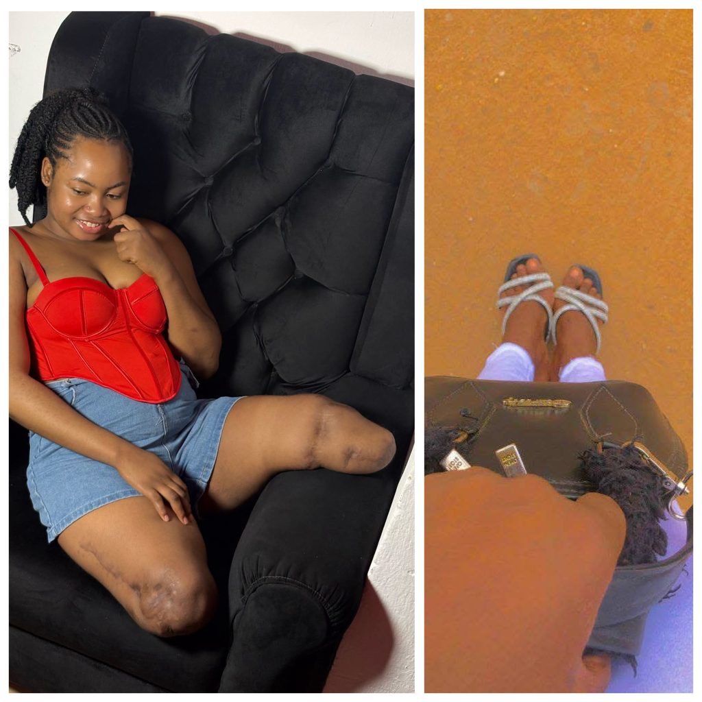 I Wish I Stayed Home That Day - Nigerian Woman Who Lost Both Legs In Accident Shares Her Regrets